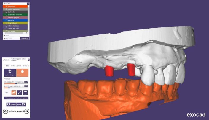 CAD-CAM