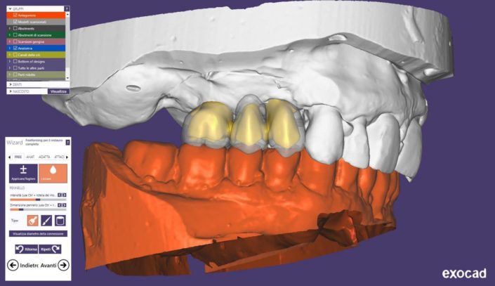 CAD-CAM