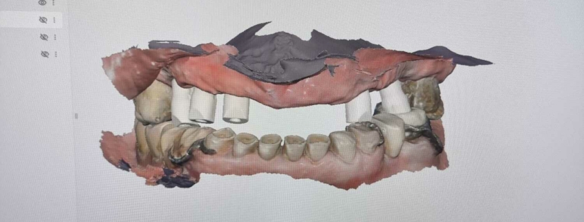 Odontotecnica full-digital Laboratorio Cialdella